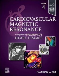 Cardiovascular Magnetic Resonance