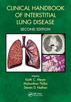 Clinical Handbook of Interstitial Lung Disease, 2nd edition (Original PDF from Publisher)