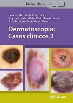 Dermatoscopia: Casos clinicos 2 (Scanned PDF)