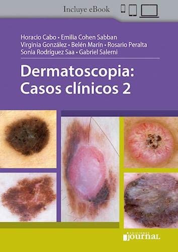 Dermatoscopia: Casos clinicos 2 (Scanned PDF) Dermatoscopia: Casos clinicos 2 (Scanned PDF)