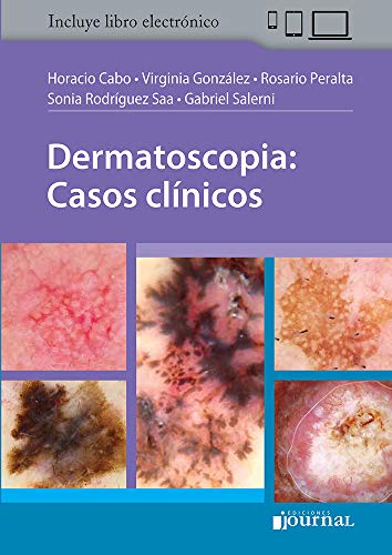 Dermatoscopia: Casos clínicos (Spanish Edition) (Scanned PDF) Dermatoscopia: Casos clínicos (Spanish Edition) (Scanned PDF)