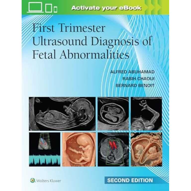 First Trimester Ultrasound Diagnosis of Fetal Abnormalities, 2nd edition (EPUB) First Trimester Ultrasound Diagnosis of Fetal Abnormalities, 2nd edition (EPUB)