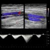 Oakstone Clinical Approach to Vascular Ultrasound and RPVI Prep Course 2026 Oakstone Clinical Approach to Vascular Ultrasound and RPVI Prep Course 2026