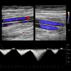 Oakstone Clinical Approach to Vascular Ultrasound and RPVI Prep Course 2026