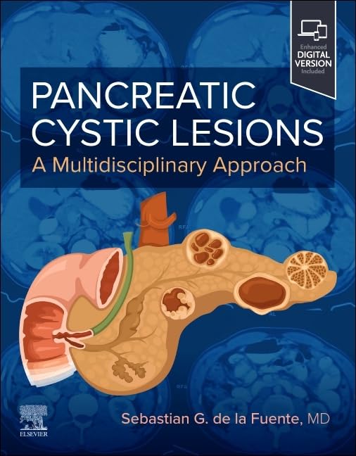 Pancreatic Cystic Lesions: A Multidisciplinary Approach (True PDF) Pancreatic Cystic Lesions