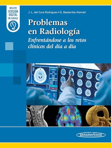 Problemas en Radiología: Enfrentándose a los retos clínicos del día a día (Original PDF from Publisher) Problemas en Radiología: Enfrentándose a los retos clínicos del día a día (Original PDF from Publisher)