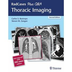 RadCases Plus Q&A Thoracic Imaging, 2nd Edition (Original PDF from Publisher)