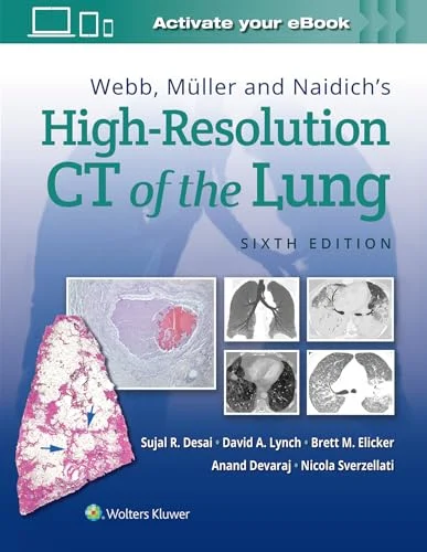 Webb, Müller and Naidich’s High-Resolution CT of the Lung, 6th edition (Original PDF from Publisher) Webb, Müller and Naidich’s High-Resolution CT of the Lung, 6th edition (Original PDF from Publisher)
