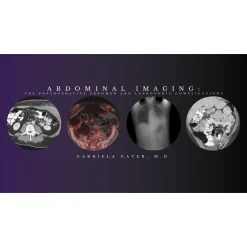 Abdominal Imaging – Gabriela Gayer, M.D. (CMEScience) (Videos)