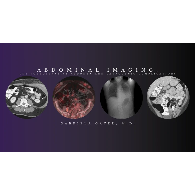Abdominal Imaging – Gabriela Gayer, M.D. (CMEScience) (Videos) Abdominal Imaging – Gabriela Gayer, M.D. (CMEScience) (Videos)